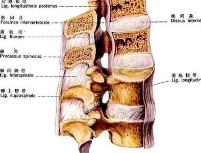 什么能治疗脊椎炎 什么是脊椎炎 脊椎炎的治疗