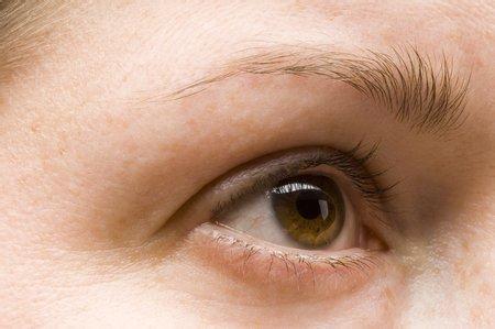 天生黑眼圈是什么原因 天生黑眼圈的食疗是什么