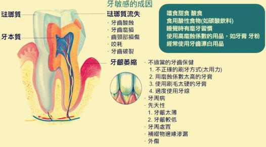 牙齿过敏能自愈吗 牙齿过敏的原因