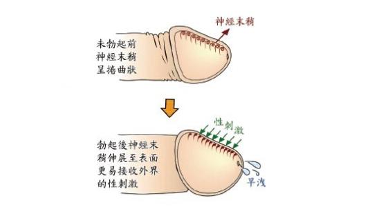 早射是什么原因引起的 早射的原因有哪些