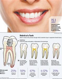 牙齿再生长新牙偏方 为什么牙齿不能再生