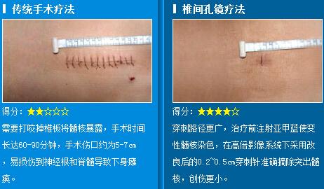 腰椎病有哪些并发症 腰椎病怎么形成的 腰椎病成因和并发症