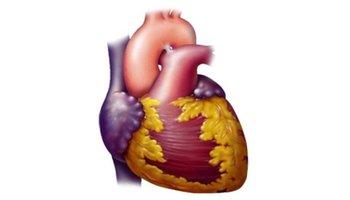 心室颤动 引起心室颤动的原因是什么