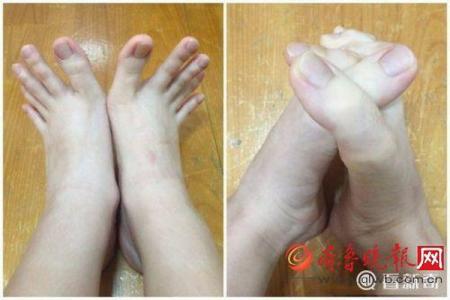 世界上最长的脚趾甲 世界上脚趾最长的人简介