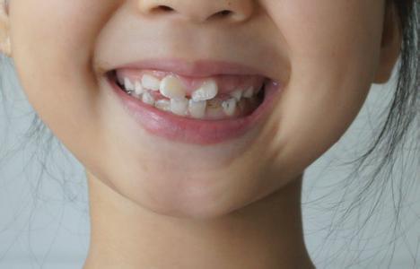 孩子牙齿不齐 九岁孩子牙齿不齐怎么办