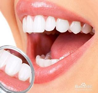 洗牙能把牙齿洗白吗 洗牙为什么牙齿会白