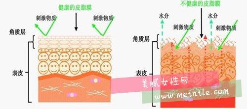 角质层薄用什么护肤品 角质层薄的5个护肤技巧