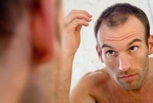 26岁脱发严重怎么办 26岁男性如何防止脱发掉发