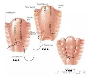 产后大出血是什么原因 产后内检出血的原因是什么