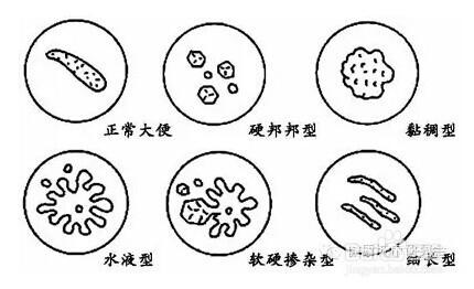 大便颜色健康对照表 大便颜色知健康