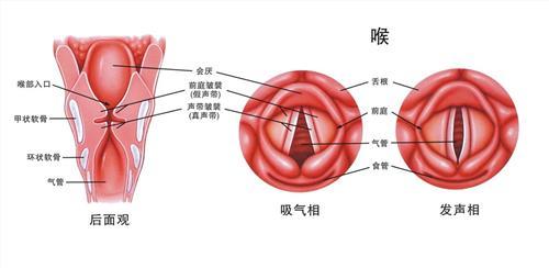 咽喉炎的成因 咽炎是什么形成的 咽炎成因和治疗