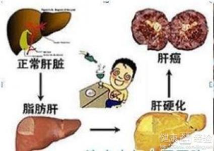 什么原因会引起脂肪肝 脂肪肝什么原因