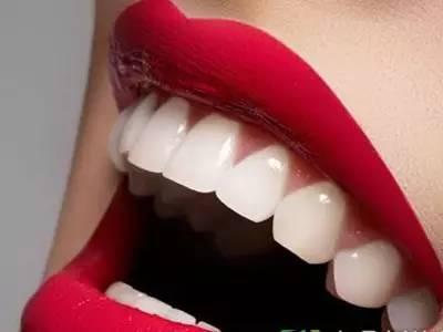 如何清除牙垢 牙垢是如何形成的 牙垢的预防和清除