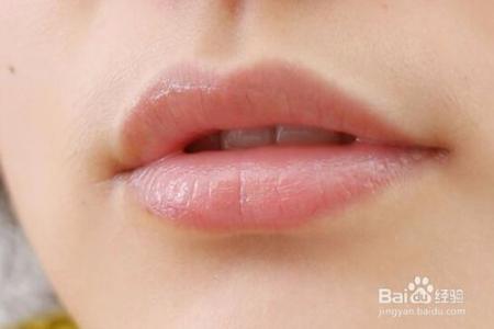 嘴唇脱皮是什么原因 嘴唇脱皮是什么原因 嘴唇脱皮的原因