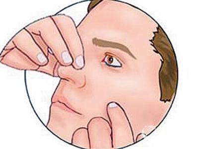 鼻子外面出血怎么回事 鼻子出血时怎么办