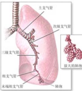 如何预防新生儿肺炎 如何预防新生儿湿肺