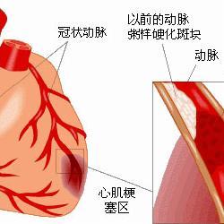 心脏病是怎么形成的 心脏病是怎么形成的 心脏病的表现和治疗