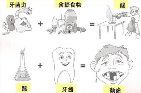 怎么清除牙菌斑 牙菌斑怎么形成的 牙菌斑的危害和清除