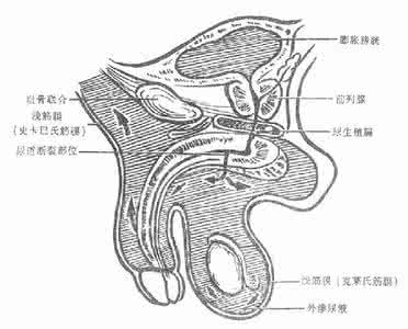 药物外渗的预防及处理 什么是尿外渗 尿外渗的预防方法