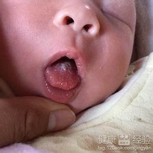 舌苔厚白是怎么回事 11个月的宝宝舌苔厚黄怎么回事