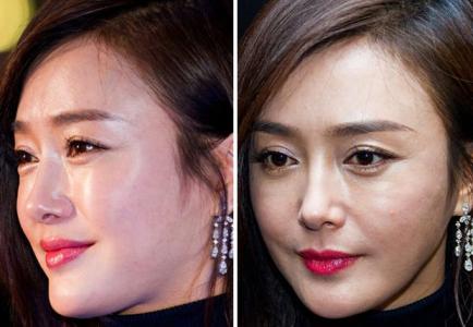 什么人不能打瘦脸针 打瘦脸针有什么危害