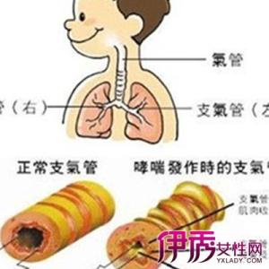 支气管炎咳嗽怎么治 治支气管炎咳嗽的方法