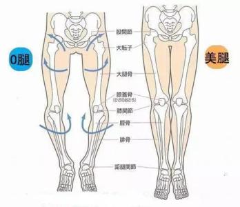 罗圈腿是怎么形成的 罗圈腿怎么形成的 罗圈腿的成因与治疗