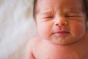 婴儿奶粉过敏如何处理 婴儿奶粉过敏怎么办