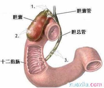 胆囊息肉是怎么引起的 胆息肉病因