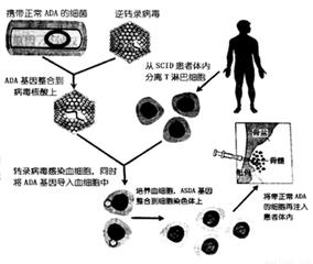 免疫缺陷病的治疗 什么是免疫缺陷病 免疫缺陷病的治疗