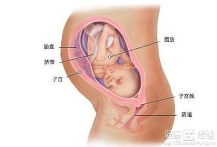 胎盘前置怎么调整 什么原因会导致胎盘前置