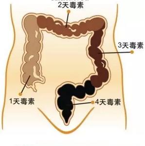 空腹一天能清肠排毒吗 肠道如何排毒