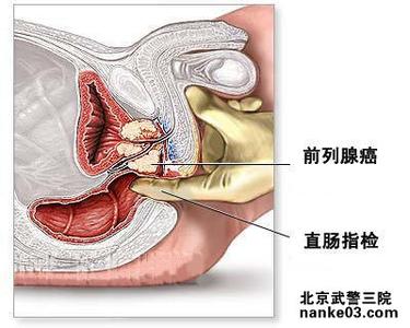 前列腺食疗偏方大全 前列腺的食疗方法