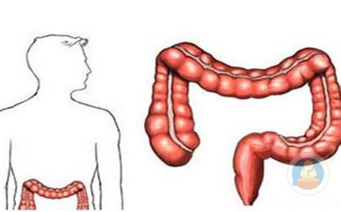 肠炎和肠癌的症状区别 肠癌的临床表现