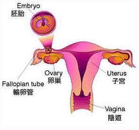 什么原因导致宫外孕 导致宫外孕几率增加的原因