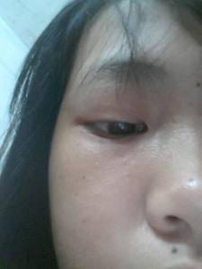 怎样使脸上斑去掉 怎么把脸上的斑去掉