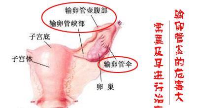 治疗外阴痒小妙招 外阴瘙痒怎么办