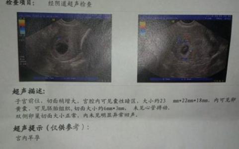 辞职信怎么写 范文 因怀孕的辞职信怎样写及范文