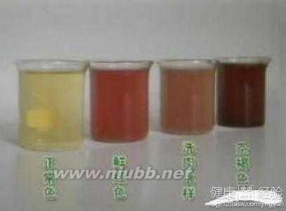 北京男性治疗血尿科 男性血尿治疗方法
