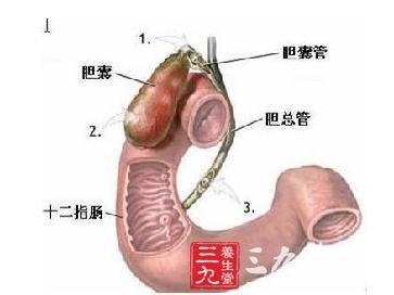 慢性胆管炎的症状 胆管炎的病因