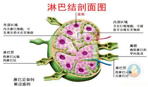 淋巴瘤有什么症状 淋巴瘤怎么形成的 淋巴瘤有什么病症