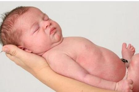 新生儿脑缺氧的症状 新生儿缺氧是什么 新生宝宝缺氧有哪些症状