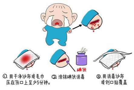 创伤的急救方法 创伤急救方法