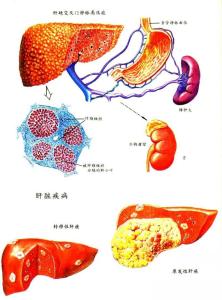 肝炎症状表现有哪些 不同类型肝炎会有哪些表现