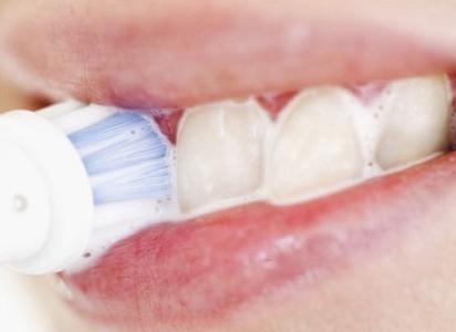 怎么除牙齿上的牙垢 牙齿上的牙石怎么去除