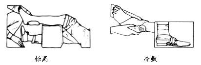 撕裂伤的急救措施 扭伤的急救措施