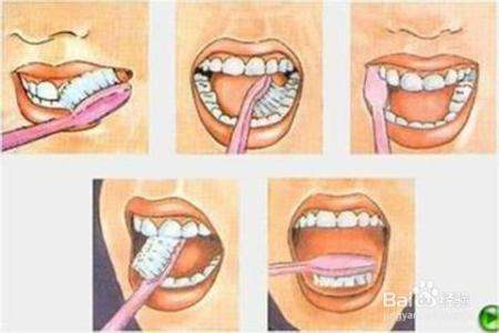 怎样去除牙齿内壁污垢 怎样有效去除牙齿污垢
