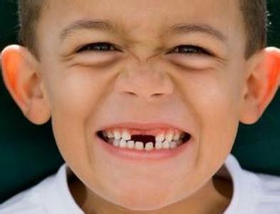 中年人牙齿脱落的原因 牙齿脱落怎么办