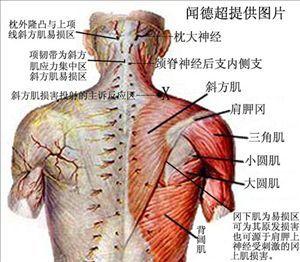 背部疼痛是什么原因 背部下方疼痛的原因是什么