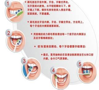 牙齿矫正后注意事项 牙齿保健方法与注意事项